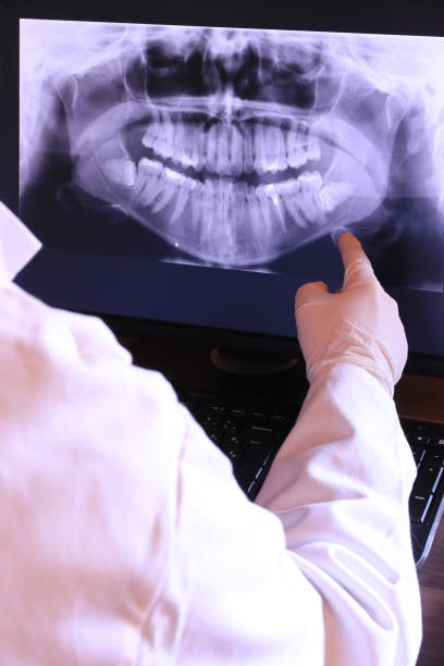 Best Emergency Root Canal Treatment in East Jordan, MI